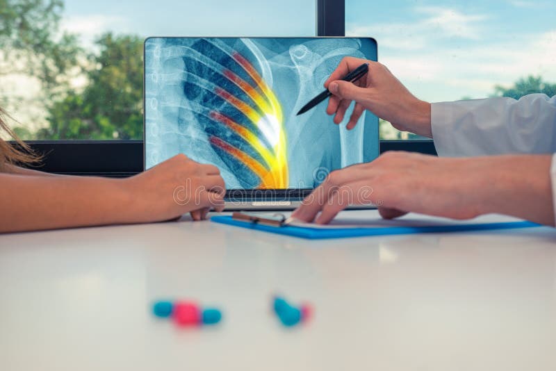Medico che mostra i raggi x del petto e del dolore sulle costole su un computer portatile ad un paziente della donna Pillole sull fotografie stock Medico che mostra i raggi x del petto e del dolore sulle costole su un computer portatile ad un paziente della donna Pillole sull fotografie stock