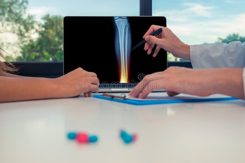 Medico che mostra i raggi x della gamba con dolore nella caviglia su un computer portatile ad un paziente della donna Pillole sul fotografia stock libera da diritti Medico che mostra i raggi x della gamba con dolore nella caviglia su un computer portatile ad un paziente della donna Pillole sul fotografia stock libera da diritti