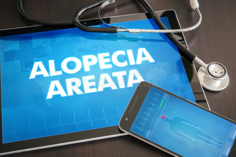 Medizinisches Konzept der Diagnose des Alopecia areata (Haut- Krankheit) an lizenzfreies stockbild Medizinisches Konzept der Diagnose des Alopecia areata (Haut- Krankheit) an lizenzfreies stockbild