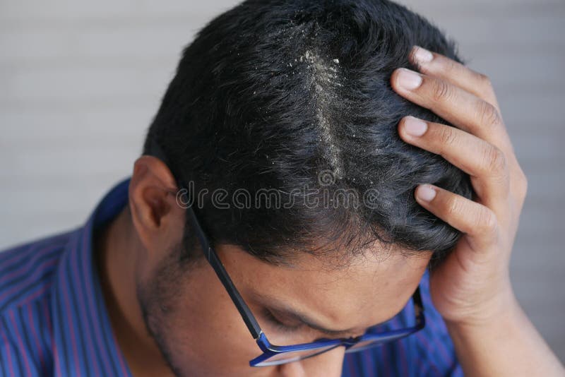 403 Men Messy Hair Stock Photos - Free & Royalty-Free Stock Photos from  Dreamstime