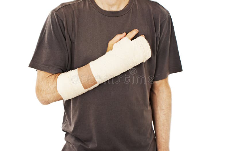 Men With His Broken Right Arm Stock Photo Image of health, recovery 50429444