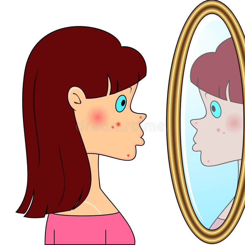 Menina do adolescente com acne ilustração royalty free Menina do adolescente com acne ilustração royalty free