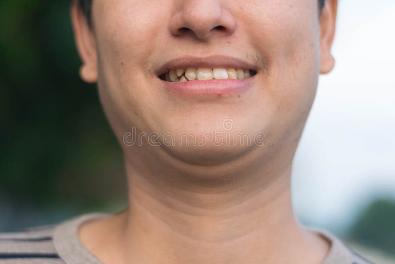 Mens die zijn tanden het glimlachen tonen royalty-vrije stock foto's Mens die zijn tanden het glimlachen tonen royalty-vrije stock foto's