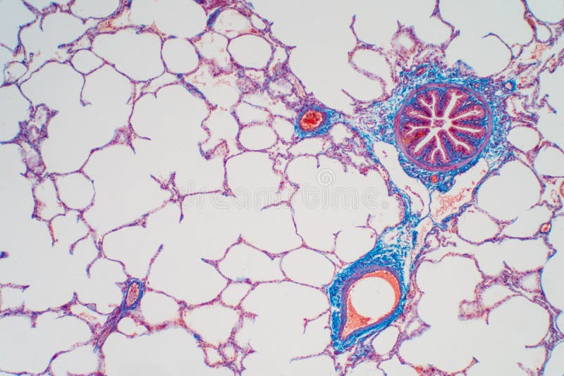 Human lung tissue under microscope, The lungs is organs of the respiratory system in humans. Human pathology education. Human lung tissue under microscope, The lungs is organs of the respiratory system in humans. Human pathology education