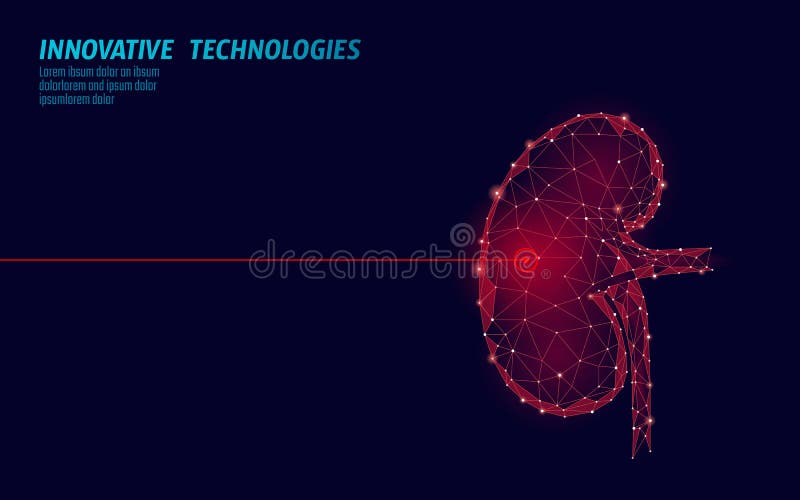 Menselijke van de de chirurgieverrichting van de nierenlaser lage poly Van de de drugbehandeling van de geneeskundeziekte het pij stock illustratie Menselijke van de de chirurgieverrichting van de nierenlaser lage poly Van de de drugbehandeling van de geneeskundeziekte het pij stock illustratie