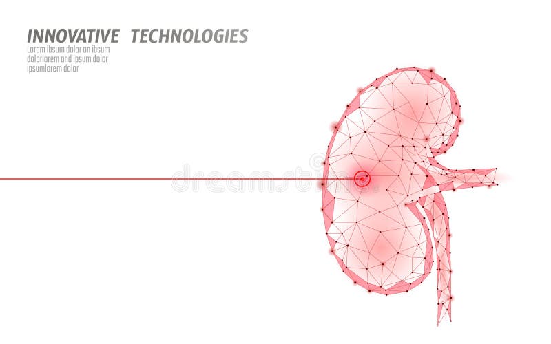 Menselijke van de de chirurgieverrichting van de nierenlaser lage poly Van de de drugbehandeling van de geneeskundeziekte het pij vector illustratie Menselijke van de de chirurgieverrichting van de nierenlaser lage poly Van de de drugbehandeling van de geneeskundeziekte het pij vector illustratie