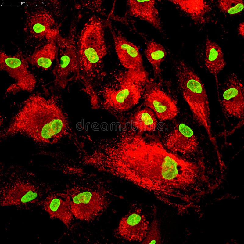 Mesenchymal Stammzellen
