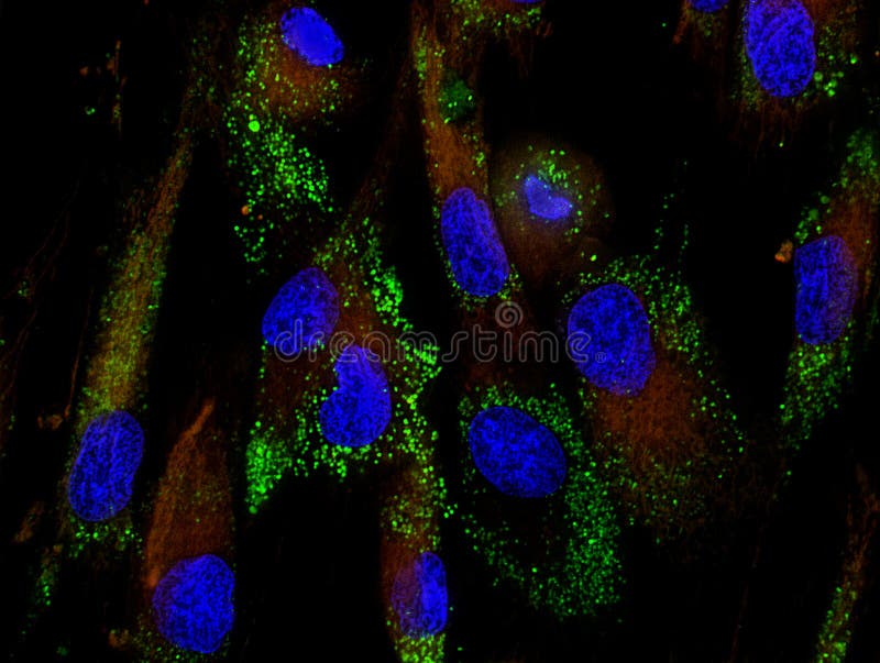 Mesenchymal Stammzellen beschriftet mit Fluoreszenzmolekülen