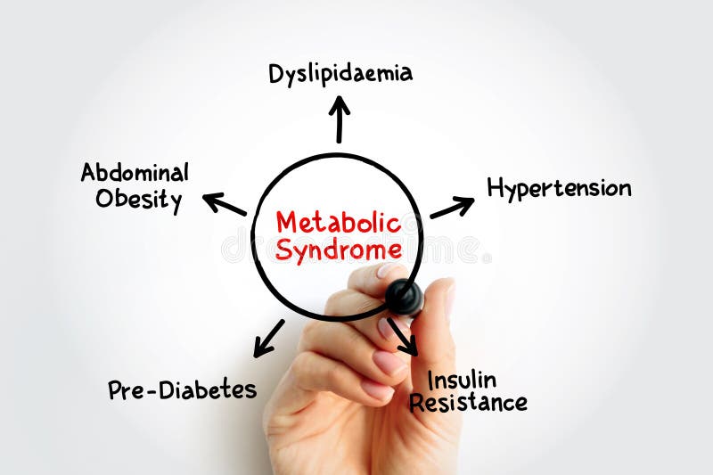 Metabolic Syndrome mind map process, medical concept for presentations and reports. Design mind map stock images, royalty-free photos and pictures