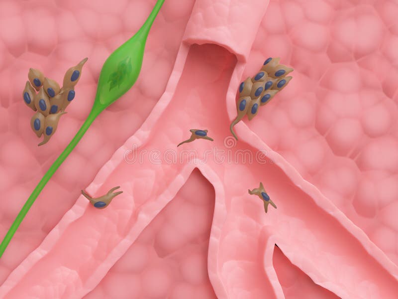 metastasis vektor illustrationer metastasis vektor illustrationer