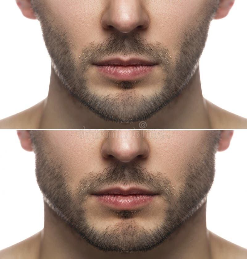 Mewing Exercises. Result of a Jawline Reshape Stock Photo - Image of  reshape, plastic: 245717018