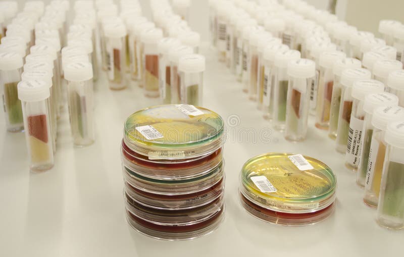 Microbial Cultures and Petri Dishes in Science Lab, with Tools for