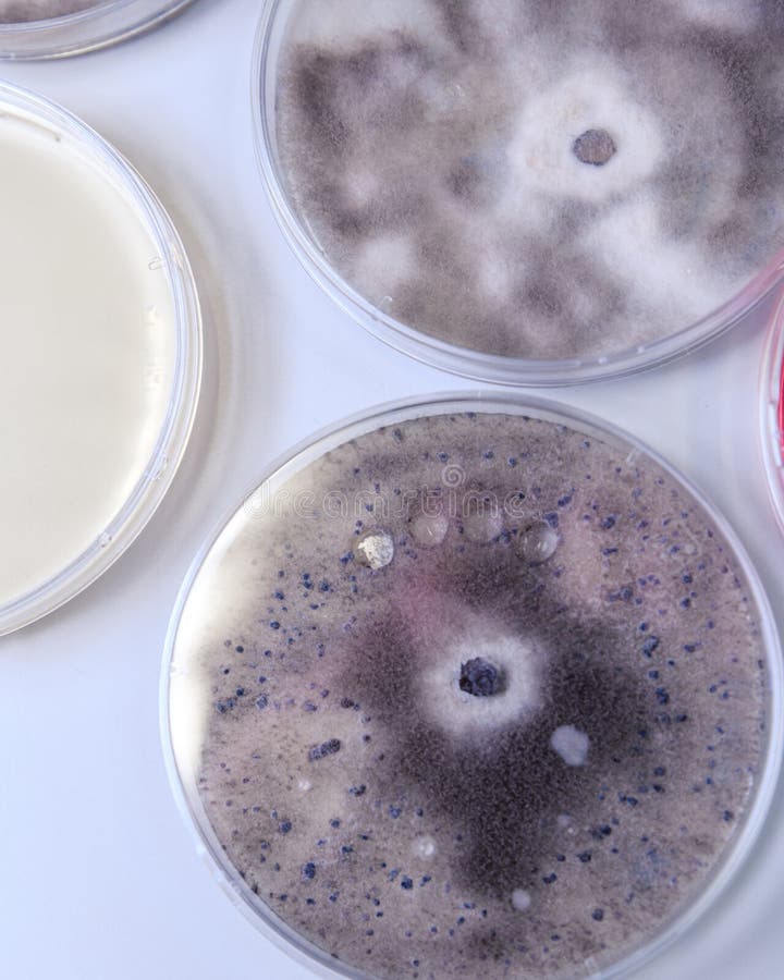 Microbiological Culture in a Petri Dish for Pharmaceutical Bioscience