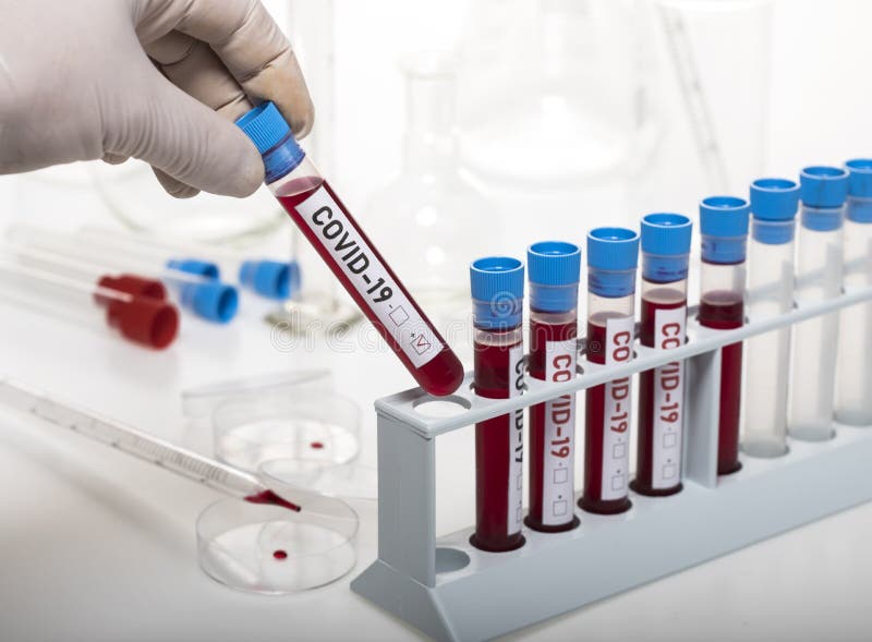 Microbiologist with a Tube of Biological Sample Contaminated by