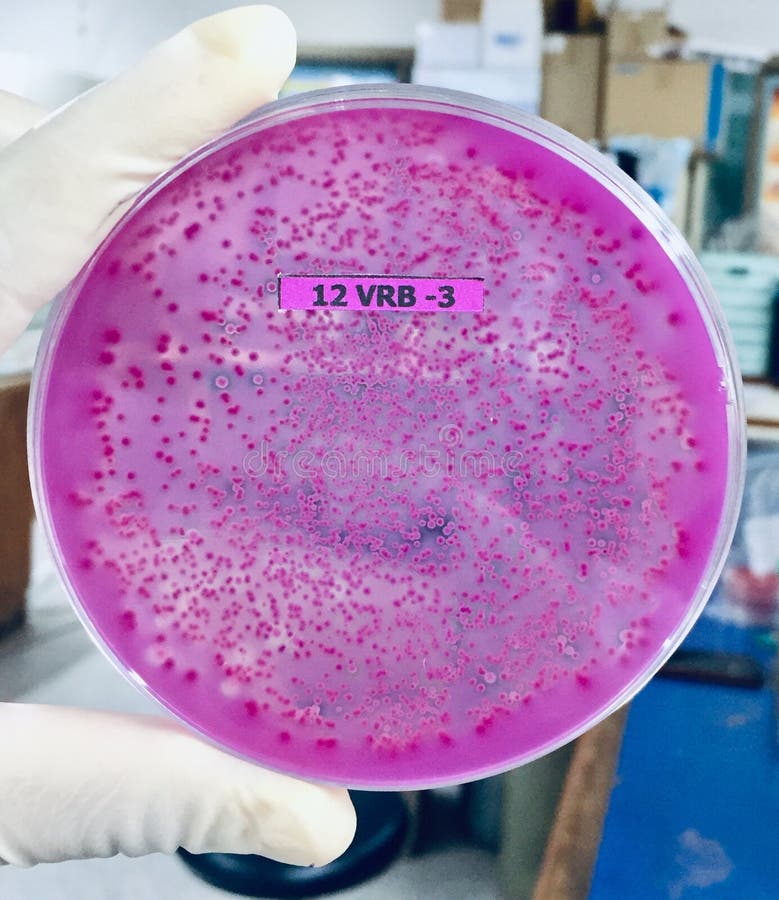 1 735 Microbiology Pink Photos Free Royalty Free Stock Photos From Dreamstime 1 735 Microbiology Pink Photos Free Royalty Free Stock Photos From Dreamstime
