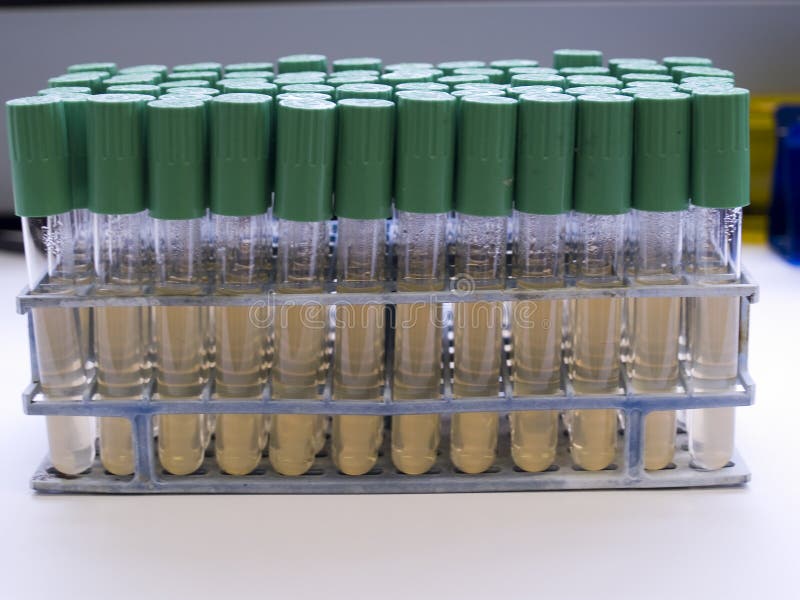 Microbiology media stock image. Image of health, research 6482913