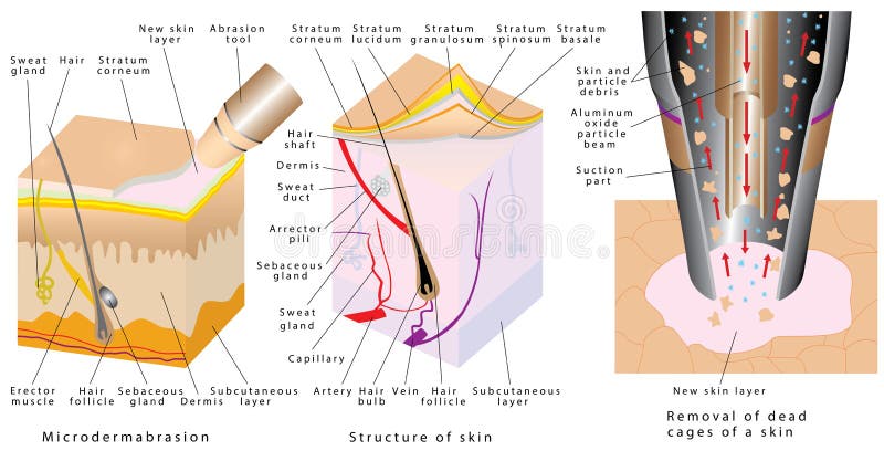 Microdermabrasion Stock Illustrations – 105 Microdermabrasion Stock  Illustrations, Vectors &amp; Clipart - Dreamstime