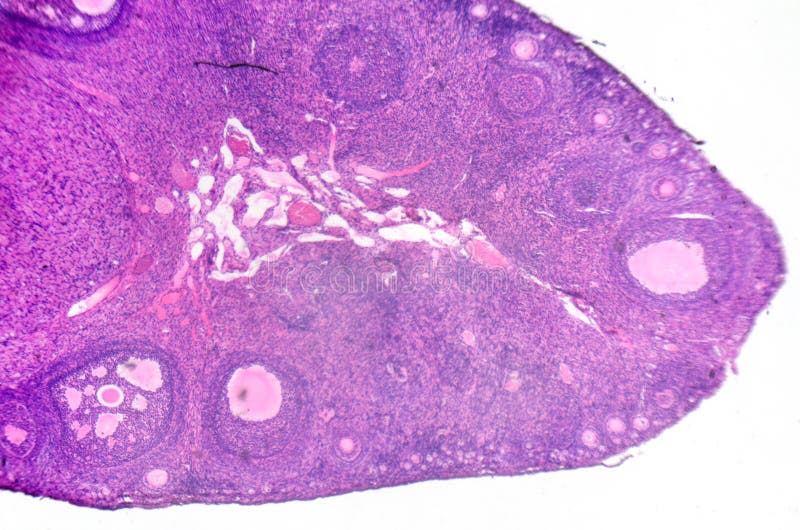 Micrographe d'ovaire montrant les FO primordiales, primaires et secondaires photographie stock libre de droits Micrographe d'ovaire montrant les FO primordiales, primaires et secondaires photographie stock libre de droits