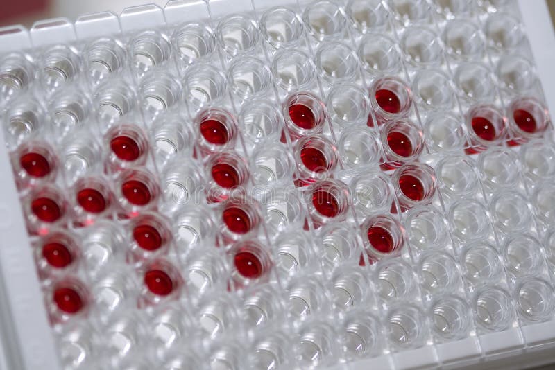 Microplate For ELISA With HIV Abbreviation Stock Image Image of