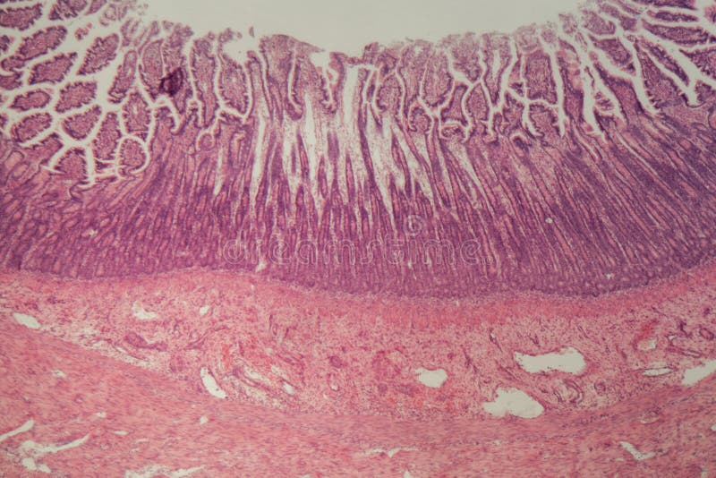 Moans Sinewi Admission fee Microscope Photo of a Large Intestine Section with Inflammation Colitis  Stock Photo - Image of histology, gastroenterology: 137225830