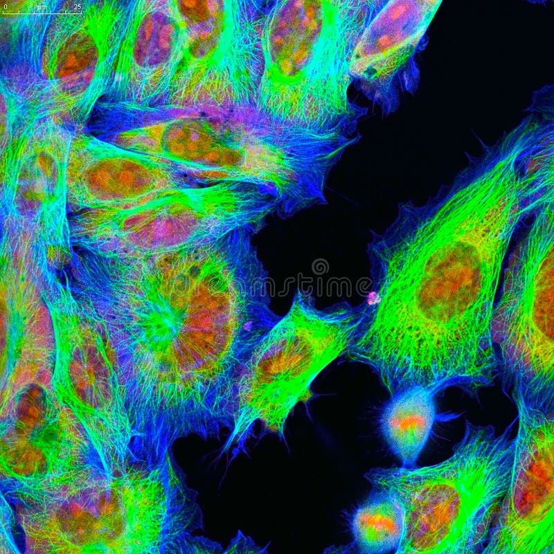 Microscopia Confocal de pilhas do fibroblasto foto de stock Microscopia Confocal de pilhas do fibroblasto foto de stock