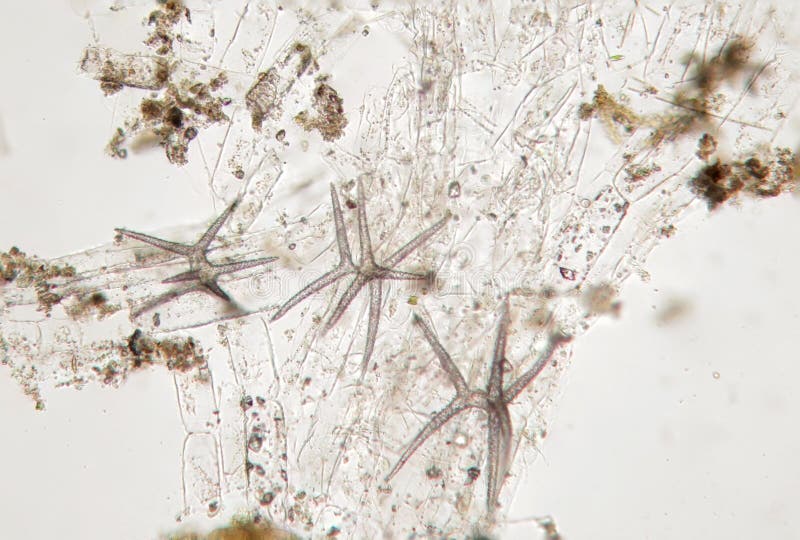 Microscopic life, spiked algae hedgehog, probably diatom algae. Freshwater phytoplankton by microscope stock images
