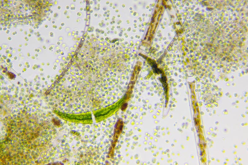 Microscopic view of different types of algae stock photo