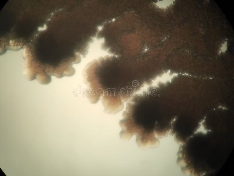 Branched Bacterial Colonies Under the Microscope Stock Image Image of