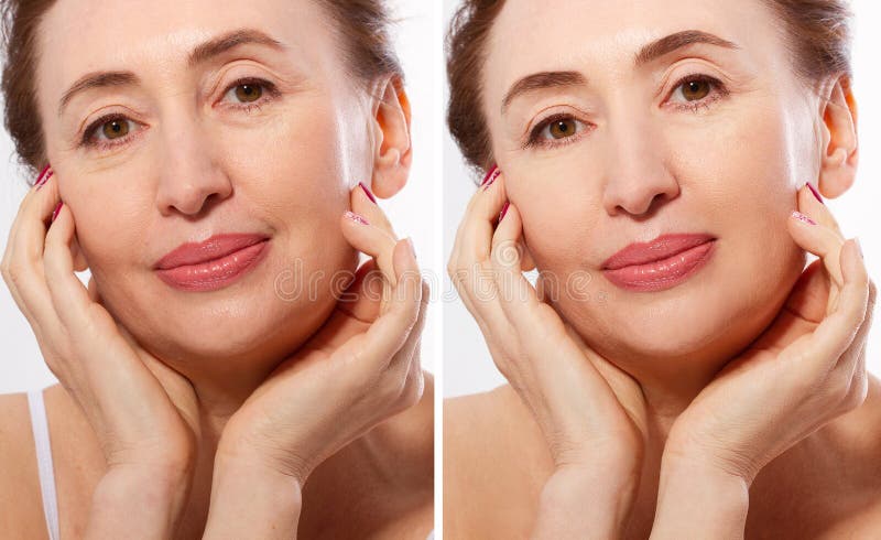 Middle age close up woman happy face before after cosmetic procedures. Skin care for wrinkled face. Before-after anti-aging royalty free stock photography Middle age close up woman happy face before after cosmetic procedures. Skin care for wrinkled face. Before-after anti-aging royalty free stock photography