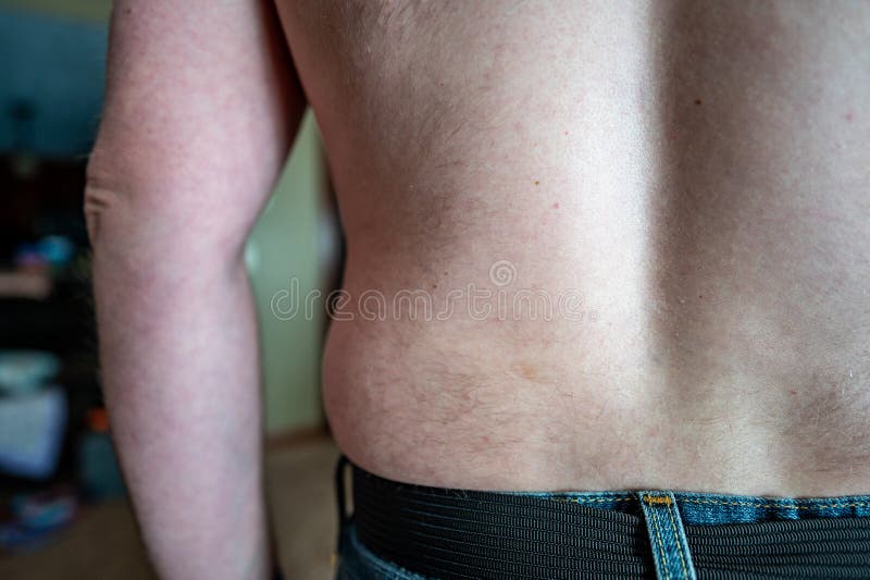 Middle Aged White Male with Patchy Back Hair Stock Image - Image of health, handles: 207069897 Middle Aged White Male with Patchy Back Hair Stock Image - Image of health, handles: 207069897
