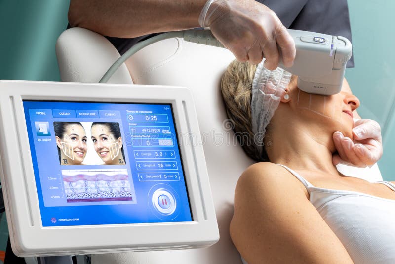 Middle aged woman receiving high intensity focused ultrasound treatment on face