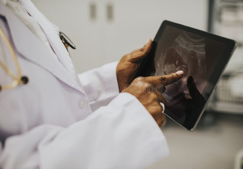 Midwife looking at a sonogram