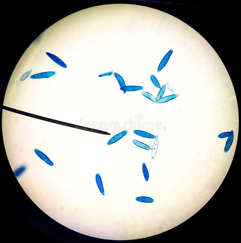 Microsporum gypseum  at  40x ,  microscope, wet mount technique. Microsporum gypseum  at  40x ,  microscope, wet mount technique