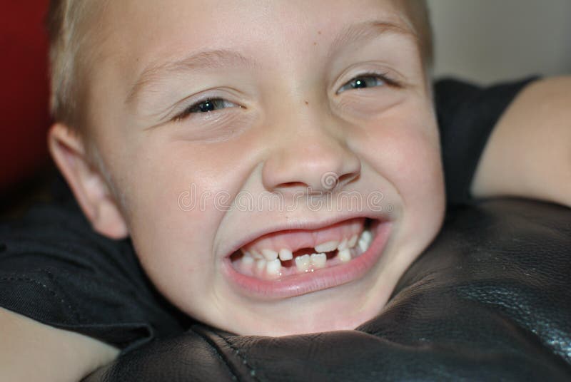 Milk teeth stock image. Image of child, changing, blonde 45133711