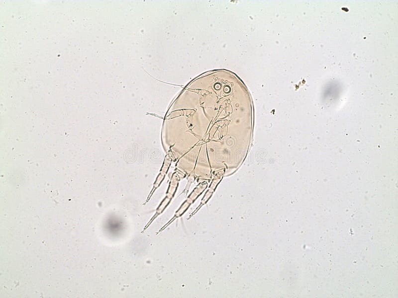 Small acarid under microscope from bird nest. Small acarid under microscope from bird nest.