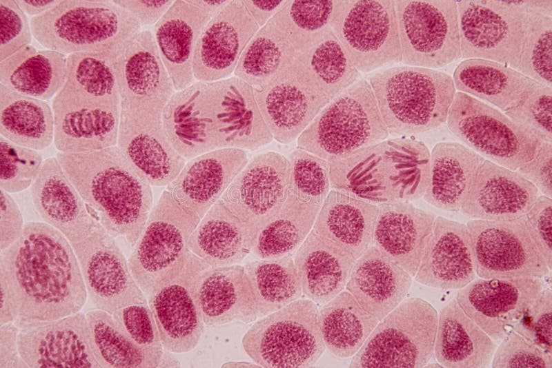Mitosis Celular En La Punta Raíz De La Cebolla Bajo Un Microscopio
