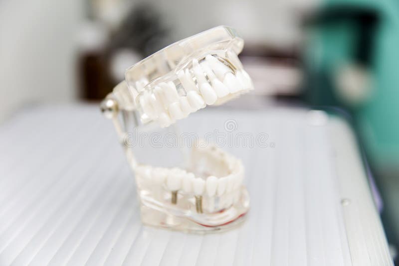 Model Dentures in Dental Office Stock Photo Image of prosthesis