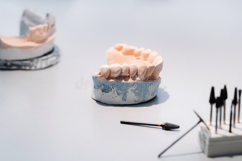 Model of Teeth Made of Plaster of the Jaw for Dental Technicians Stock