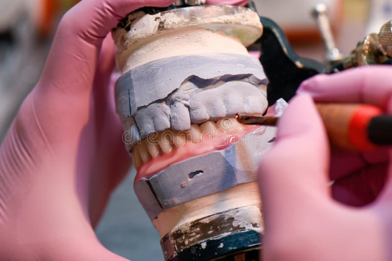Modeling the Installation of a Denture with Wax Close Up. Stock Photo