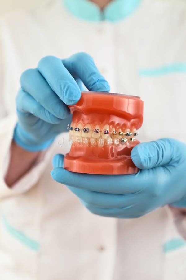 50 Pz Apparecchio Ortodontico Dentale Mini Staffe Rosse 022 - Foto 11