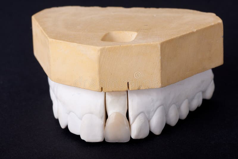 Modello dentale della cera del particolare immagine stock libera da diritti Modello dentale della cera del particolare immagine stock libera da diritti