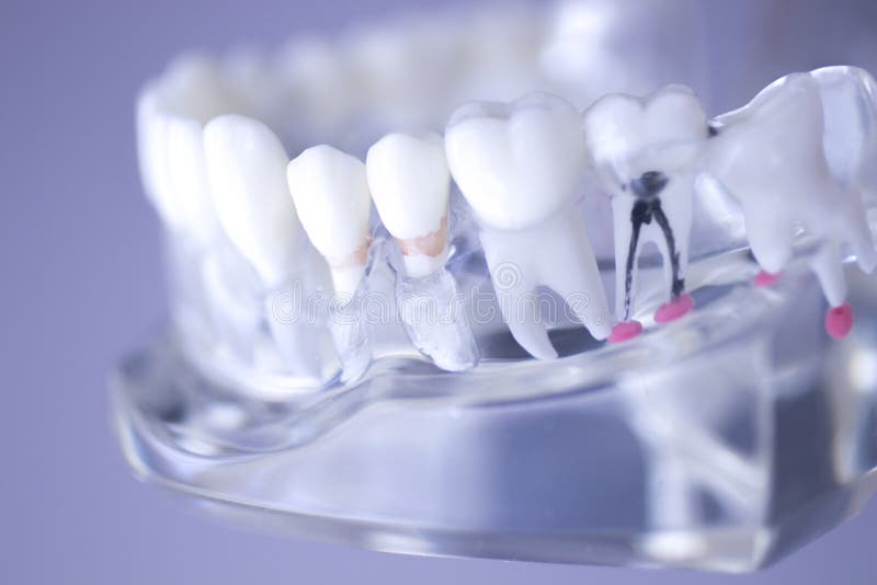 Modelo dental de la boca de los dientes imágenes de archivo libres de regalías Modelo dental de la boca de los dientes imágenes de archivo libres de regalías
