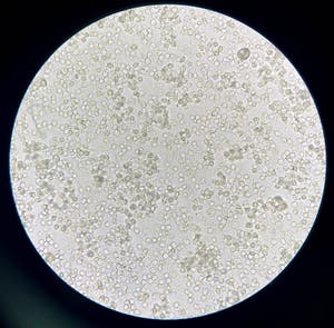 Moderate Bacteria And White Blood Cells In Urine Stock Image Image Of Health Clinical 256546305 Moderate Bacteria And White Blood Cells In Urine Stock Image Image Of Health Clinical 256546305