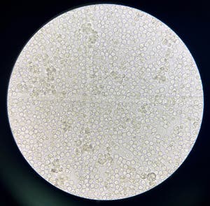 Moderate Bacteria And White Blood Cells In Urine Stock Image Image Of 
