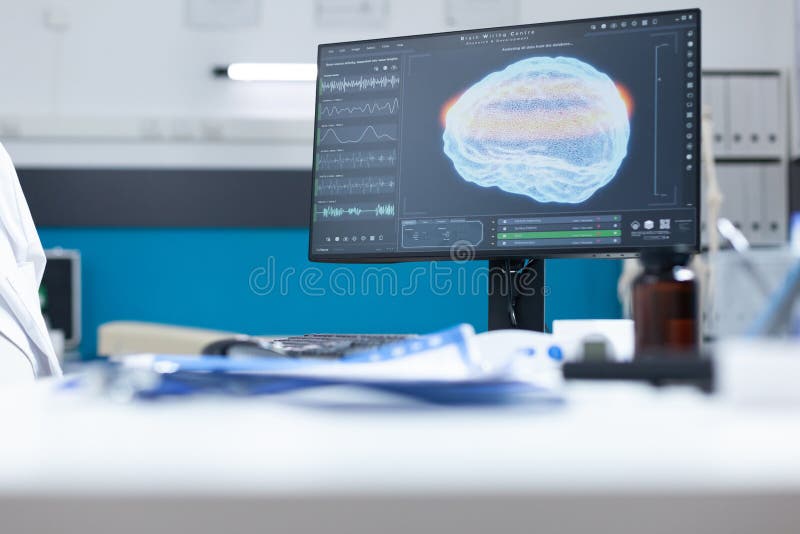 Modern empty hospital office having computer with mri brain diagaram stock images