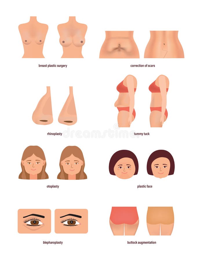 The Only Guide for Breast Surgery Types thumbnail