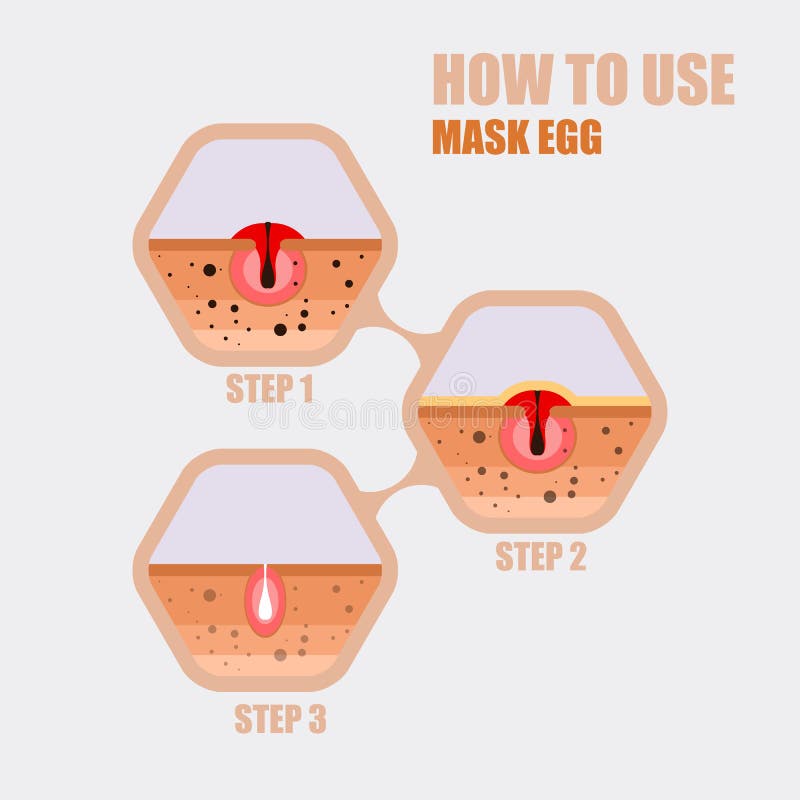 Modern vector illustration of skin problems. Dark dots, acne. Face care. Skin problems icons set. Template for website. Modern vector illustration of skin problems. Dark dots, acne. Face care. Skin problems icons set. Template for website.