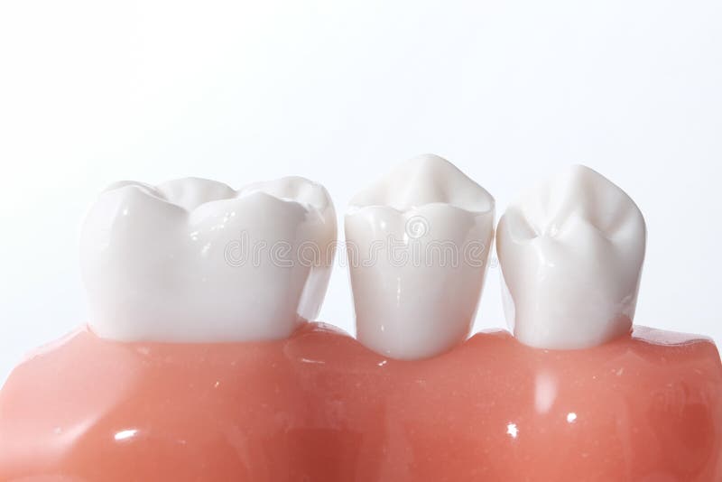 Modèle dentaire générique de dents photographie stock libre de droits Modèle dentaire générique de dents photographie stock libre de droits
