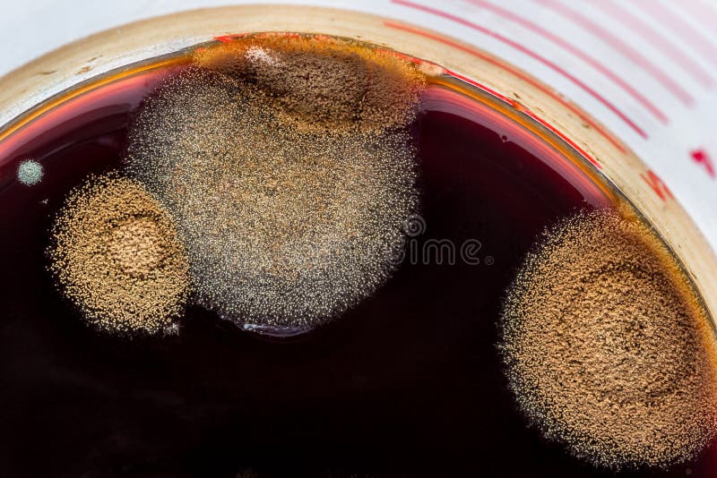 Mold Colonies Growing on Black Coffee. Stock Image Image of yeast, microbiology 58925281