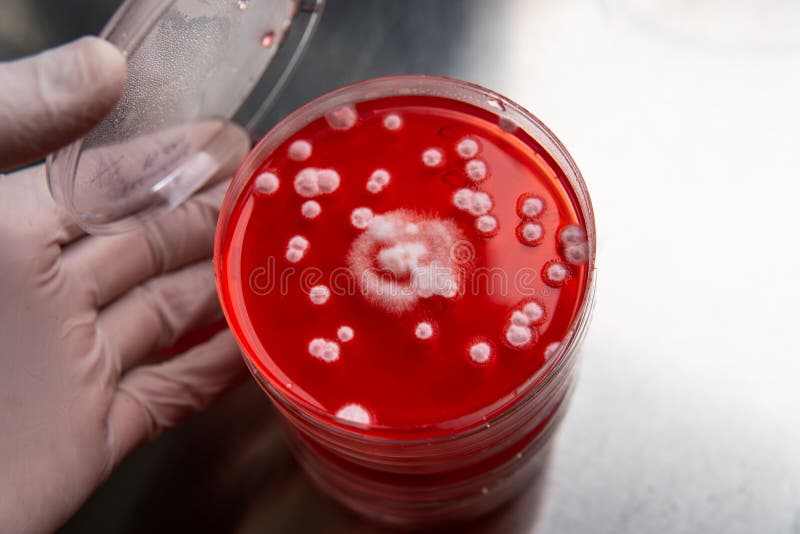 Mold in a Petri Dish. Microbiological Studies in Laboratory Conditions